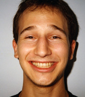 Ελκυστικό χαμόγελο - Ορθοδοντικός Δρ. Ζαρμπή