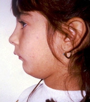 Σκελετικά προβλήματα - Ορθοδοντικός Δρ. Ζαρμπή