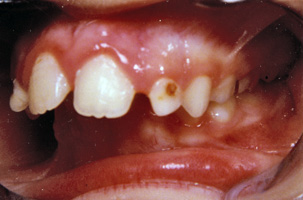 Σκελετικά προβλήματα - Ορθοδοντικός Δρ. Ζαρμπή