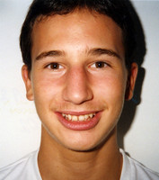 Ελκυστικό χαμόγελο - Ορθοδοντικός Δρ. Ζαρμπή