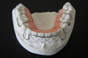 Κινητοί μηχανισμοί - Ορθοδοντικός Δρ. Ζαρμπή