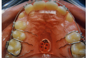 Φυσιολογικό πρόσωπο - Ορθοδοντικός Δρ. Ζαρμπή