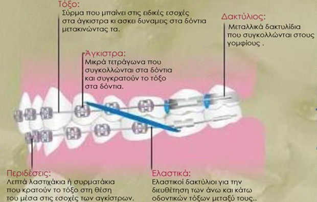 Ακίνητοι Μηχανισμοί - Ορθοδοντικός Δρ. Ζαρμπή