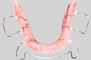 Κινητό μηχάνημα (μασελάκι) αφαιρούμενο - Ορθοδοντικός Δρ. Ζαρμπή