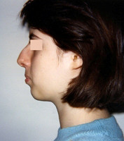 Πλαστική Χειρουργική - Ορθοδοντικός Δρ. Ζαρμπή