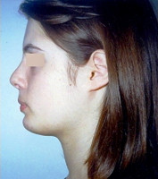 Πλαστική Χειρουργική - Ορθοδοντικός Δρ. Ζαρμπή