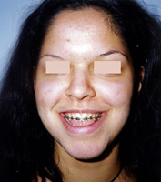 Χειρουργική επέμβαση - Ορθοδοντικός Δρ. Ζαρμπή