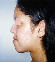 Χειρουργική επέμβαση - Ορθοδοντικός Δρ. Ζαρμπή