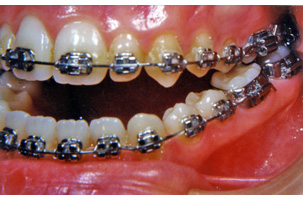 Χειρουργική επέμβαση - Ορθοδοντικός Δρ. Ζαρμπή