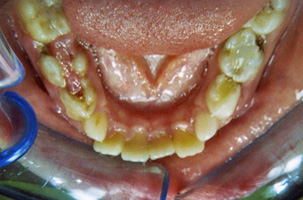 Οδοντιατρική - Ορθοδοντικός Δρ. Ζαρμπή