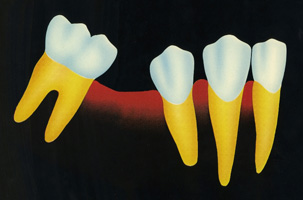 Προσθετική - Ορθοδοντικός Δρ. Ζαρμπή