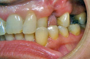 Προσθετική - Ορθοδοντικός Δρ. Ζαρμπή