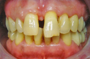 Περιοδοντολογία - Ορθοδοντικός Δρ. Ζαρμπή