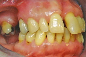 Περιοδοντολογία - Ορθοδοντικός Δρ. Ζαρμπή