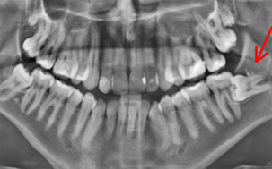 Γναθοχειρουργική - Ορθοδοντικός Δρ. Ζαρμπή