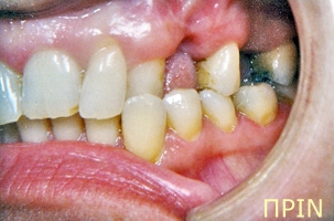 Ορθοδοντική θεραπεία - Ορθοδοντικός Δρ. Ζαρμπή