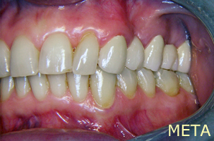 Ορθοδοντική θεραπεία - Ορθοδοντικός Δρ. Ζαρμπή