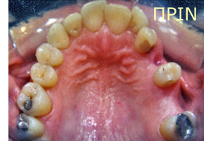 Ορθοδοντική θεραπεία - Ορθοδοντικός Δρ. Ζαρμπή