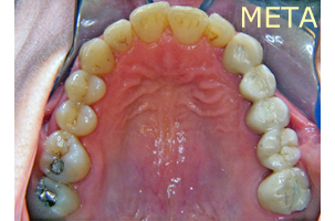 Ορθοδοντική θεραπεία - Ορθοδοντικός Δρ. Ζαρμπή