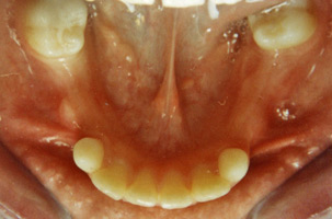 Προληπτική ορθοδοντική - Δρ. Ζαρμπή