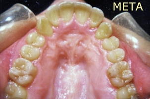 Ορθοδοντική θεραπεία - Ορθοδοντικός Δρ. Ζαρμπή