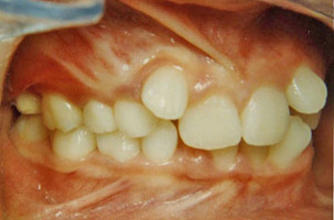 Προληπτική ορθοδοντική - Δρ. Ζαρμπή