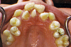 Προληπτική ορθοδοντική - Δρ. Ζαρμπή