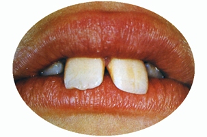 Προληπτική ορθοδοντική - Δρ. Ζαρμπή