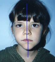 Προληπτική ορθοδοντική - Δρ. Ζαρμπή