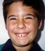 Προληπτική ορθοδοντική - Δρ. Ζαρμπή