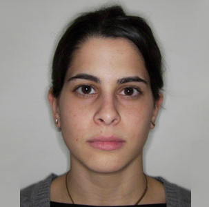 Φυσιολογικό πρόσωπο - Ορθοδοντικός Δρ. Ζαρμπή, διδάκτωρ Πανεπιστημίου