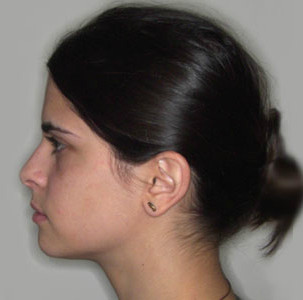 Φυσιολογικό πρόσωπο - Ορθοδοντικός Δρ. Ζαρμπή, διδάκτωρ Πανεπιστημίου