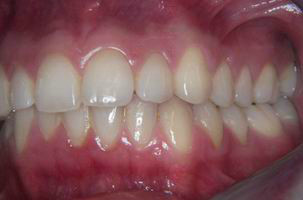 Φυσιολογικό στόμα - Ορθοδοντικός Δρ. Ζαρμπή, διδάκτωρ Πανεπιστημίου