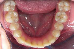 Φυσιολογικό στόμα - Ορθοδοντικός Δρ. Ζαρμπή, διδάκτωρ Πανεπιστημίου